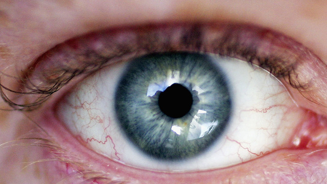 woman who got tattoo on eyeball could lose sight warns others wpxi woman who got tattoo on eyeball could lose sight warns others wpxi