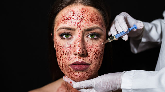 2 clients of spa that offered 'vampire facials' diagnosed with HIV - Boston 25 News thumbnail